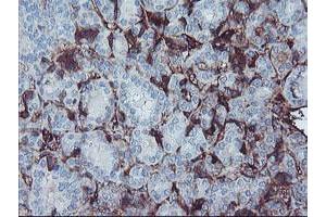 Image no. 1 for anti-alpha-2-HS-Glycoprotein (AHSG) antibody (ABIN1496502) (Fetuin A antibody)