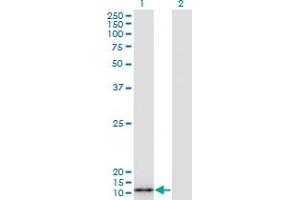 Western Blot analysis of S100A7 expression in transfected 293T cell line by S100A7 monoclonal antibody (M07A), clone 3E11.