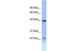 WB Suggested Anti-HOXA2 Antibody Titration: 1. (HOXA2 antibody  (C-Term))
