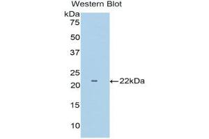 Western Blotting (WB) image for anti-Tumor Necrosis Factor Receptor Superfamily, Member 1B (TNFRSF1B) (AA 303-474) antibody (ABIN3206519) (TNFRSF1B antibody  (AA 303-474))