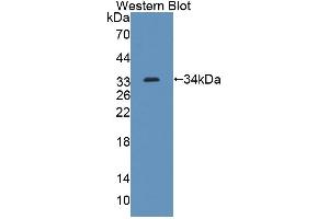 Detection of Recombinant ABCG8, Mouse using Polyclonal Antibody to ATP Binding Cassette Transporter G8 (ABCG8) (ABCG8 antibody  (AA 1-272))