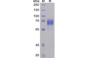 Human NTB-A Protein, mFc-His Tag on SDS-PAGE under reducing condition. (SLAMF6 Protein (mFc-His Tag))