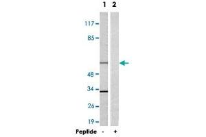 Western blot analysis of extracts from 293 cells, using TRAF3IP3 polyclonal antibody .