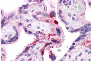 Human Placenta: Formalin-Fixed, Paraffin-Embedded (FFPE) (LRRC8B antibody  (AA 542-591))