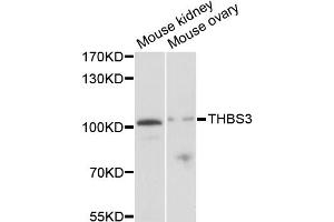 Western blot analysis of extracts of various cell lines, using THBS3 antibody (ABIN1875090) at 1:1000 dilution.