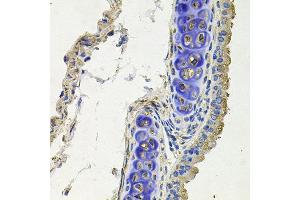 Immunohistochemistry of paraffin-embedded mouse lung using SKP1 antibody at dilution of 1:100 (x40 lens). (SKP1 antibody)