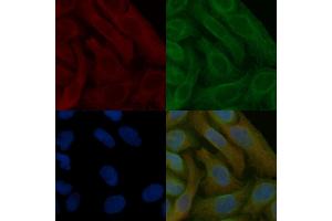 Peroxiredoxin 5 Mouse Monoclonal Antibody staining Hela cells by IF/ICC.