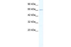 WB Suggested Anti-ZNF79 Antibody   Titration: 0.