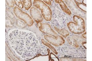 Immunoperoxidase of purified MaxPab antibody to CDH16 on formalin-fixed paraffin-embedded human kidney. (Cadherin-16 antibody  (AA 1-829))