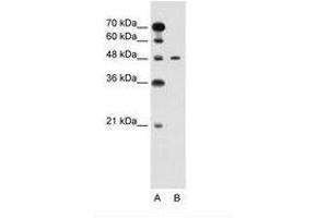 Image no. 1 for anti-Pre-B-Cell Leukemia Homeobox Protein 1 (PBX1) (N-Term) antibody (ABIN6736594) (PBX1 antibody  (N-Term))