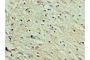 Immunohistochemistry of paraffin-embedded human brain tissue using ABIN7150554 at dilution of 1:100 (DNAJC3 antibody  (AA 1-226))