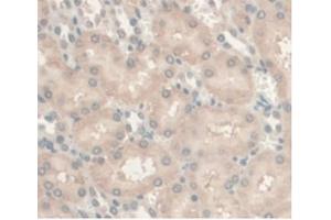 Detection of AR in Rat Kidney Tissue using Monoclonal Antibody to Androgen Receptor (AR) (Androgen Receptor antibody  (AA 491-679))