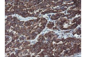 Image no. 1 for anti-Prefoldin Subunit 3 (PFDN3) antibody (ABIN1501706) (VBP1 antibody)