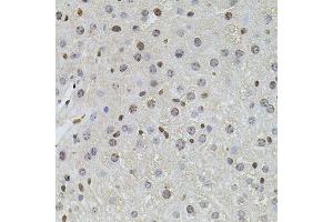 Immunohistochemistry of paraffin-embedded mouse liver using PLK4 antibody (ABIN6003595) at dilution of 1/100 (40x lens). (PLK4 antibody)