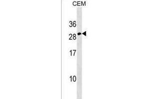 Erythropoietin Antibody (C-term) (ABIN1536744 and ABIN2849493) western blot analysis in CEM cell line lysates (35 μg/lane). (EPO antibody  (C-Term))