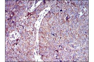 Immunohistochemistry (IHC) image for anti-Solute Carrier Family 2 (Facilitated Glucose Transporter), Member 4 (SLC2A4) (AA 224-353) antibody (ABIN1846354) (GLUT4 antibody  (AA 224-353))