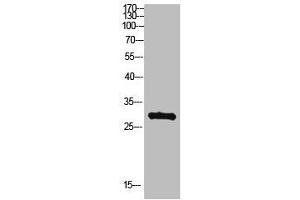 Western Blot analysis of hepg2 cells using Antibody diluted at 500. (MYOZ2 antibody  (AA 21-70))