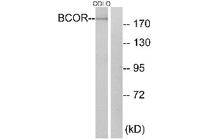 Immunohistochemistry analysis of paraffin-embedded human breast carcinoma tissue using BCOR antibody. (BCOR antibody)