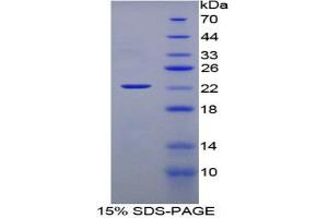 SDS-PAGE analysis of Rat Interferon alpha Protein. (IFNA Protein)