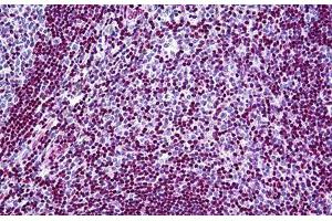 Human Tonsil: Formalin-Fixed, Paraffin-Embedded (FFPE) (MECP2 antibody  (AA 81-170))