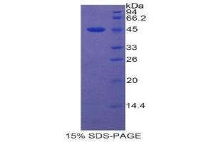SDS-PAGE (SDS) image for Lipocalin 5 (LCN5) (AA 22-177) protein (His tag,GST tag) (ABIN2123182) (LCN5 Protein (AA 22-177) (His tag,GST tag))
