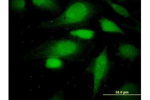 Immunofluorescence (IF) image for anti-Arginyltransferase 1 (ATE1) (AA 1-87) antibody (ABIN524510)