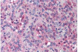 Human Spleen (formalin-fixed, paraffin-embedded) stained with XAF1 antibody ABIN214019 at 10 ug/ml followed by biotinylated goat anti-rabbit IgG secondary antibody ABIN481713, alkaline phosphatase-streptavidin and chromogen. (XAF1 antibody)