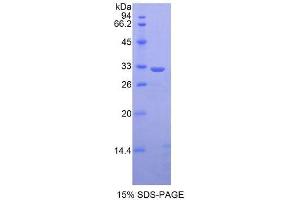 SDS-PAGE (SDS) image for Signal Transducer and Activator of Transcription 1, 91kDa (STAT1) (AA 432-680) protein (His tag) (ABIN1878314) (STAT1 Protein (AA 432-680) (His tag))