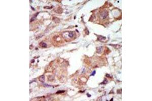 Image no. 2 for anti-Mitogen-Activated Protein Kinase Kinase Kinase 10 (MAP3K10) (C-Term) antibody (ABIN360309) (MAP3K10 antibody  (C-Term))