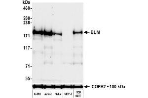 Western Blotting (WB) image for anti-Bloom Syndrome RecQ Like Helicase (BLM) (C-Term) antibody (ABIN7795725)