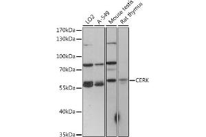 Western blot analysis of extracts of various cell lines, using CERK antibody (ABIN7266282) at 1:1000 dilution. (CERK antibody  (C-Term))