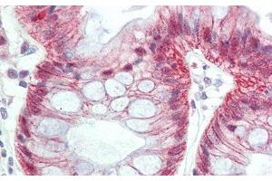 Detection of MTF1 in Human Colon Tissue using Polyclonal Antibody to Metal Regulatory Transcription Factor 1 (MTF1) (MTF1 antibody  (AA 2-139))