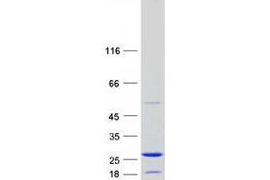 ZMAT5 Protein (Transcript Variant 1) (Myc-DYKDDDDK Tag)