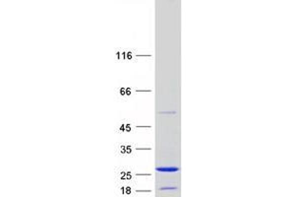 ZMAT5 Protein (Transcript Variant 1) (Myc-DYKDDDDK Tag)