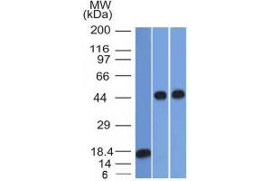 Western Blot Analysis of 1) recombinant Alpha-1-Antitrypsin 2) Jurkat & 3) A549 cell lysate using Alpha-1-Antitrypsin Mouse Monoclonal Antibody (AAT/1378). (SERPINA1 antibody)