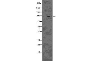 Western blot analysis of EPS15L1 using HeLa whole  lysates. (EPS15L1 antibody  (C-Term))
