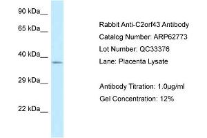 Western Blotting (WB) image for anti-Lipid Droplet-Associated Hydrolase (LDAH) (C-Term) antibody (ABIN2789241) (LDAH/C2orf43 antibody  (C-Term))