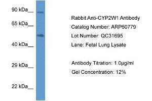 Western Blotting (WB) image for anti-Cytochrome P450, Family 2, Subfamily W, Polypeptide 1 (CYP2W1) (C-Term) antibody (ABIN2788576) (CYP2W1 antibody  (C-Term))