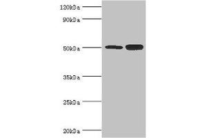 Western blot All lanes: Polycomb protein EED antibody at 4 μg/mL Lane 1: Hela whole cell lysate Lane 2: K562 whole cell lysate Secondary Goat polyclonal to rabbit IgG at 1/10000 dilution Predicted band size: 51, 54, 46 kDa Observed band size: 51 kDa (EED antibody  (AA 1-300))