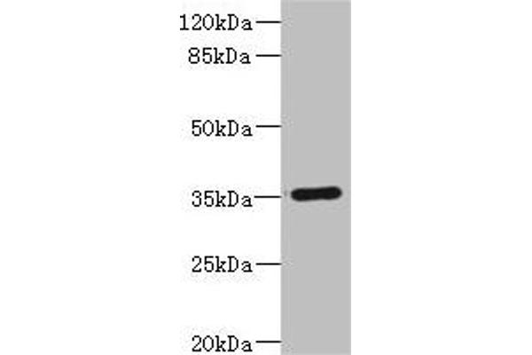 FCGR2C anticorps  (AA 43-223)