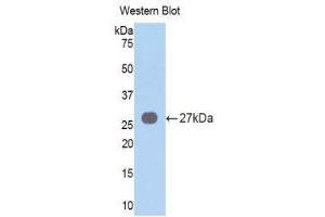 Western Blotting (WB) image for anti-Vav 3 Oncogene (VAV3) (AA 183-380) antibody (ABIN1860913) (VAV3 antibody  (AA 183-380))