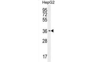 Western Blotting (WB) image for anti-CCR4-NOT Transcription Complex, Subunit 8 (CNOT8) antibody (ABIN2996023)