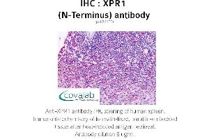Image no. 1 for anti-Xenotropic and Polytropic Retrovirus Receptor 1 (xpr1) antibody (ABIN1740878) (xpr1 antibody)
