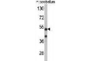 Western Blotting (WB) image for anti-Cyclin-Dependent Kinase 14 (CDK14) antibody (ABIN3002794)