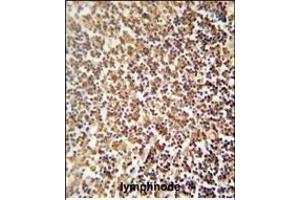 ZNF98 antibody (C-term) (ABIN654480 and ABIN2844215) immunohistochemistry analysis in formalin fixed and paraffin embedded human lymphnode followed by peroxidase conjugation of the secondary antibody and DAB staining. (ZNF98 antibody  (C-Term))