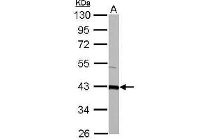 GOT2 antibody  (Center)