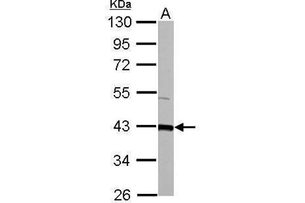 GOT2 antibody  (Center)