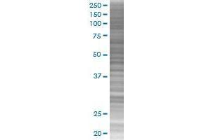 ZNF257 transfected lysate.