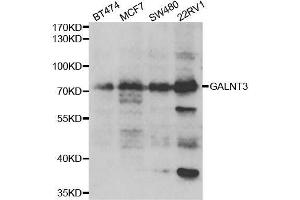 Western blot analysis of extracts of various cell lines, using GALNT3 antibody. (GALNT3 antibody  (AA 1-140))