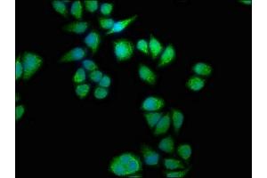 Immunofluorescence staining of Hela cells with ABIN7168857 at 1:133, counter-stained with DAPI. (Septin 11 antibody  (AA 237-429))
